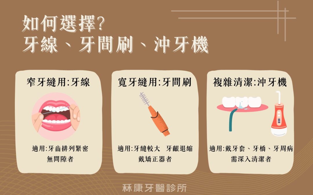 牙線、牙間刷、沖牙機怎麼選？依牙縫狀況分3類
